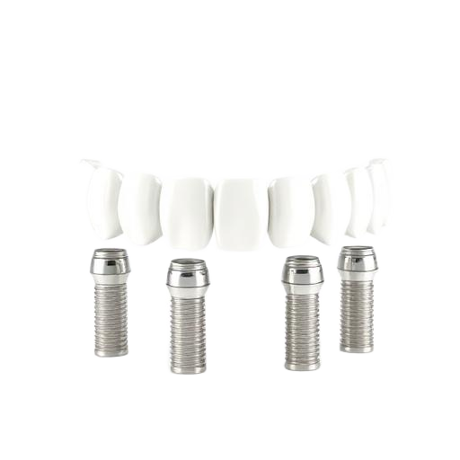 3D illustration of All-on-4 / All-on-6