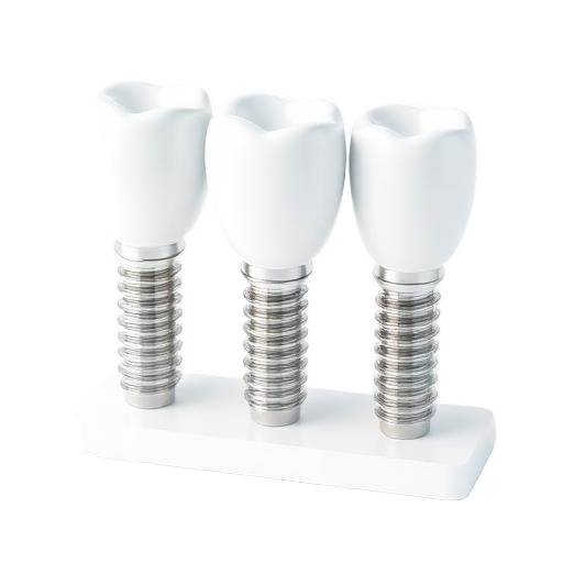 3D illustration of Implant Bridge